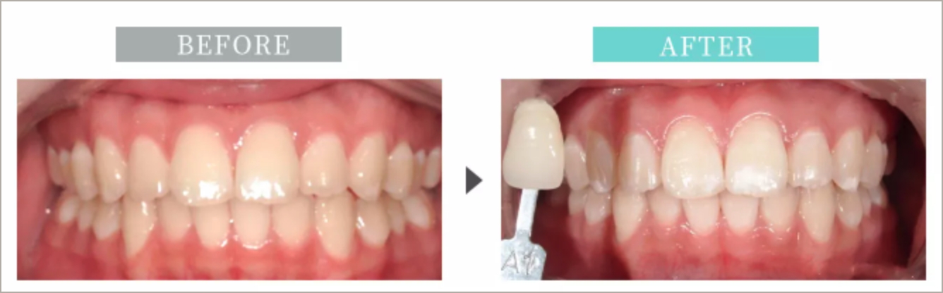 BEFORE AFTER